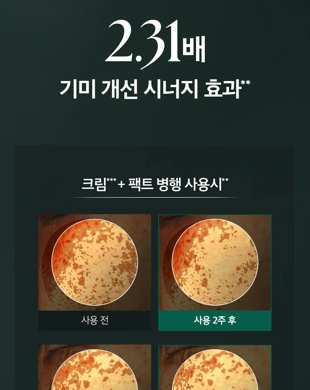 [이달의신상] 오휘 기미케어 3-STEP 콜라겐 톤업선 50ml / 데니어 팩트 리필 기획 / 멜라토닝 크림 60ml 상세페이지 64